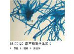 葫芦藓原丝体装片