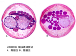蛔虫雌雄横切