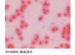 蛙血涂片