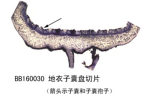 地衣子囊盘切片