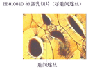 柿胚乳切片（示胞间连丝)