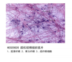 结缔组织