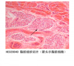结缔组织