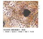 结缔组织